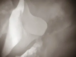 Petals 13