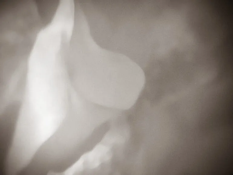 Petals 13