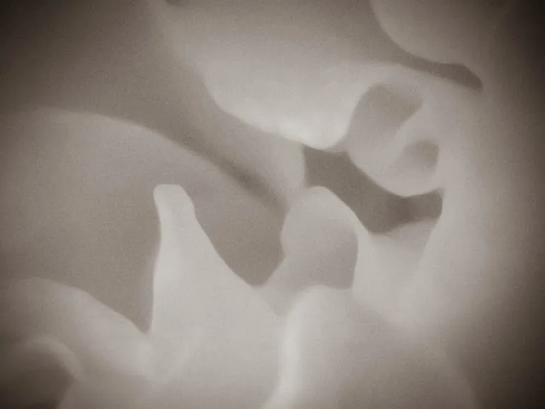 Petals 15