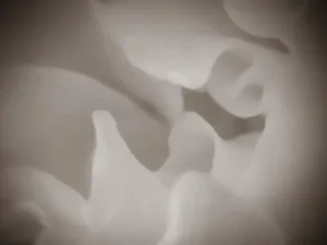 Petals 15